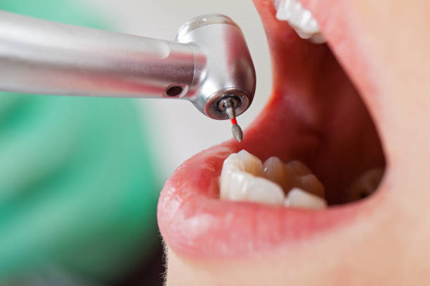 Best Broken Tooth Emergency  in Fort Drum, NY